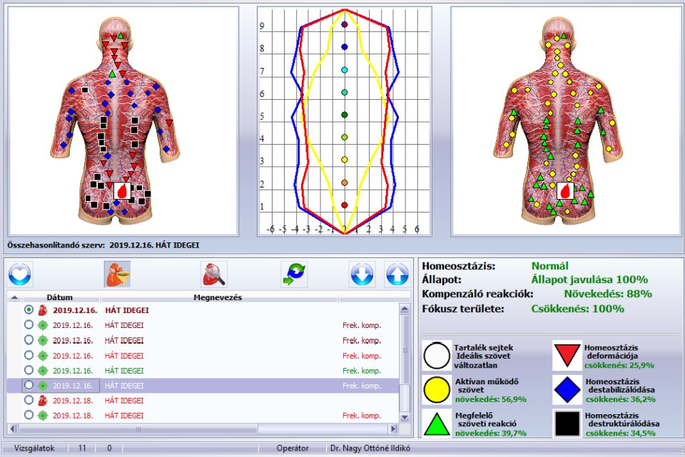 Sensitiv audit - Hát
